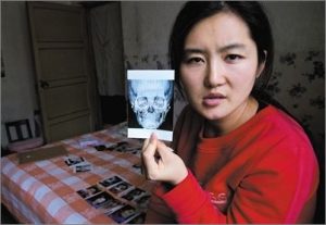 韓国整形失敗